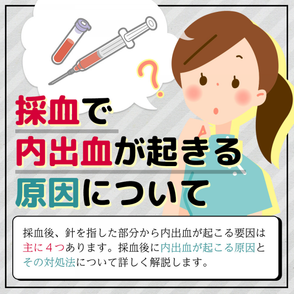 採血で内出血が起きる原因について ナスナス看護師 看護学生のための就職情報サイト