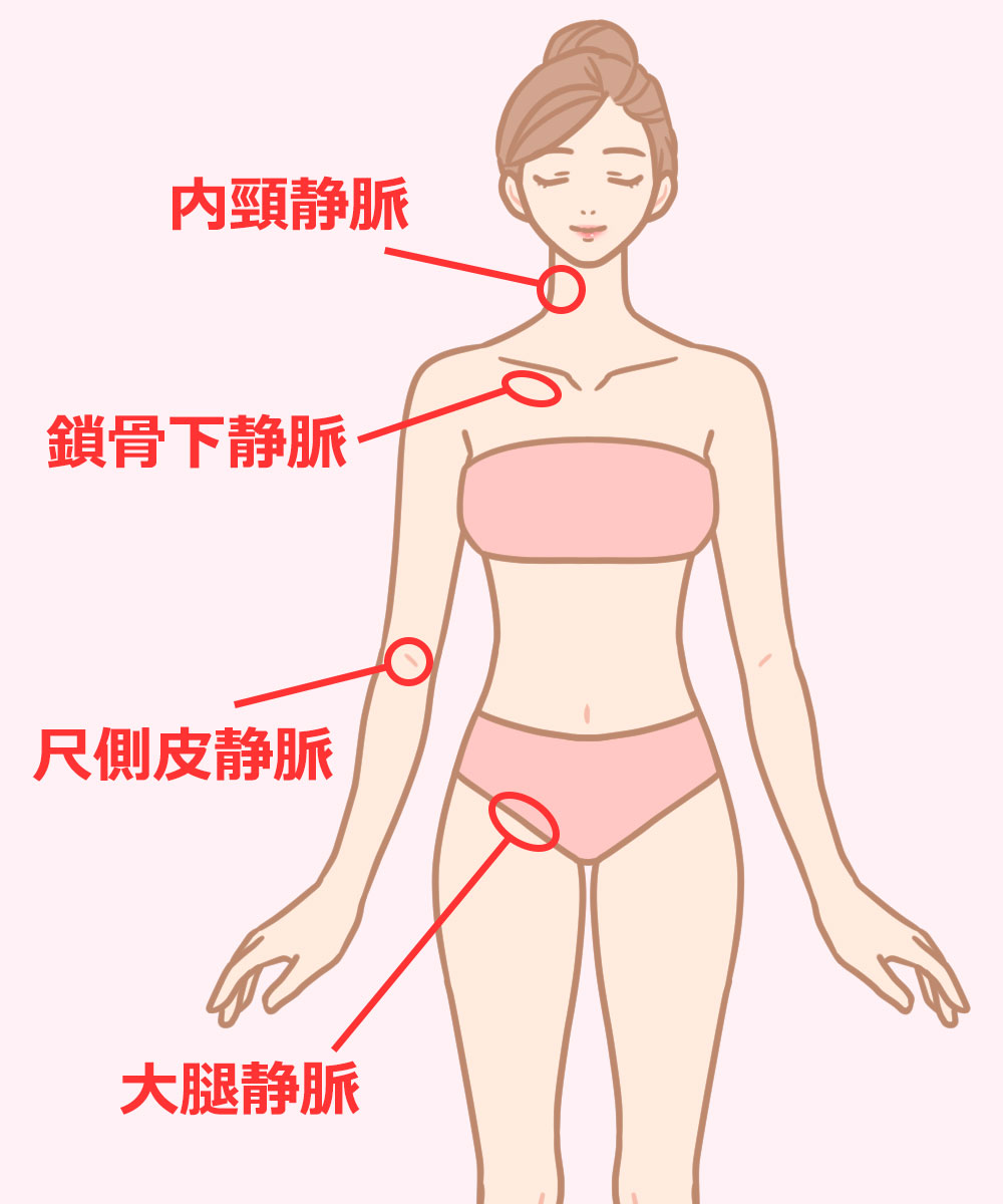 主な穿刺場所は4カ所