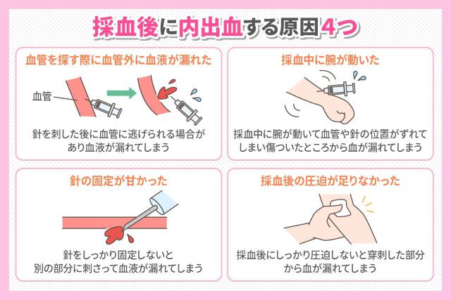 採血後に内出血が起きる4つの原因