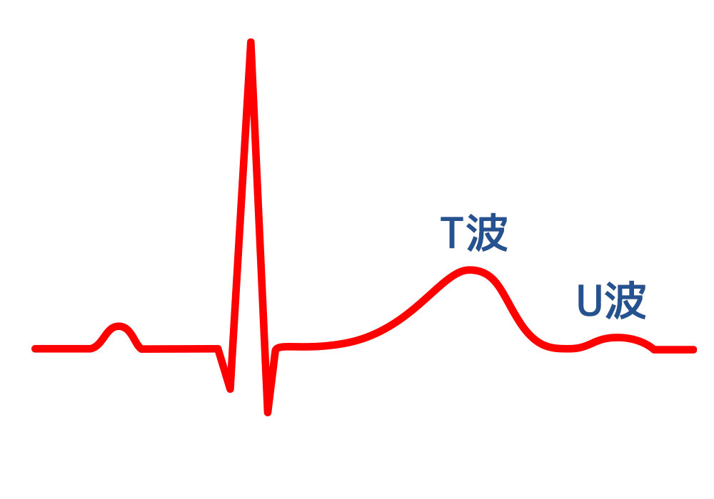 T波・U波